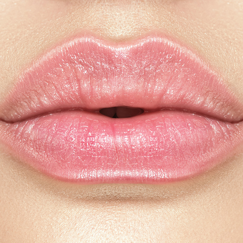 Lip Augmentation